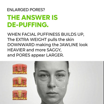 CACTOX V-LIFTING MEWING BAND